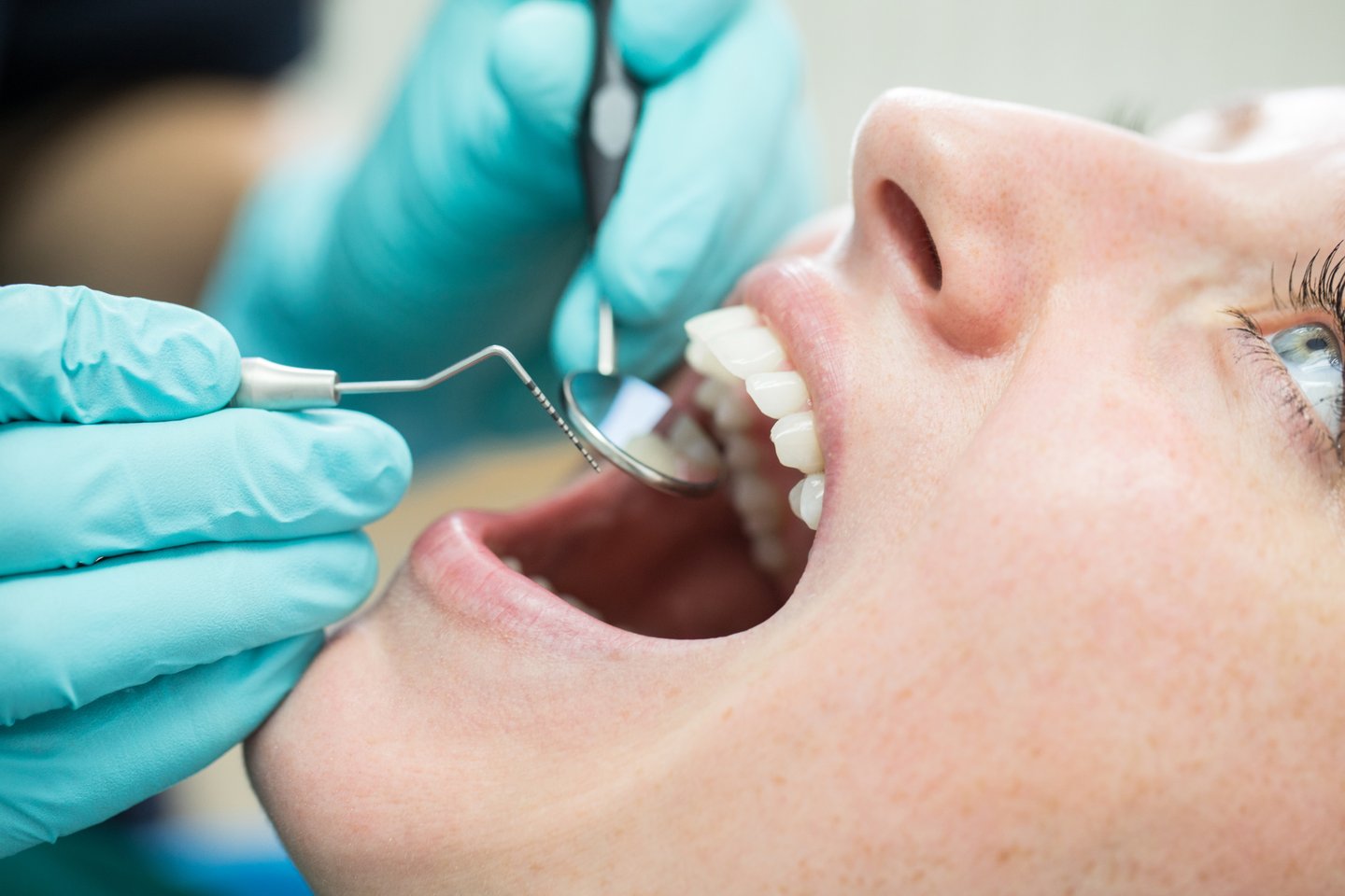 Dentistas denunciam falhas no programa de saúde oral